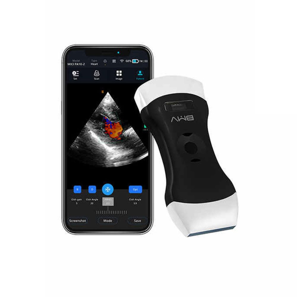 Air Essence™ UltraLite L3 aparat USG przenośny ultrasonograf