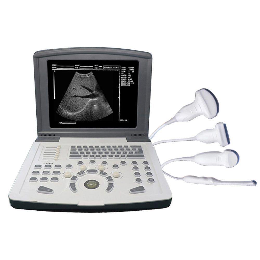 Air Essence™ UltraLite L2 aparat USG – profesjonalny przenośny ultrasonograf